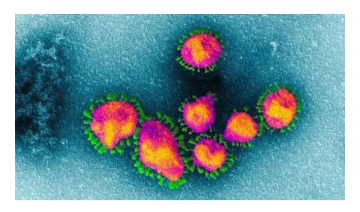 Coronavirus, il casentinese risultato positivo si era già messo in quarantena in maniera autonoma